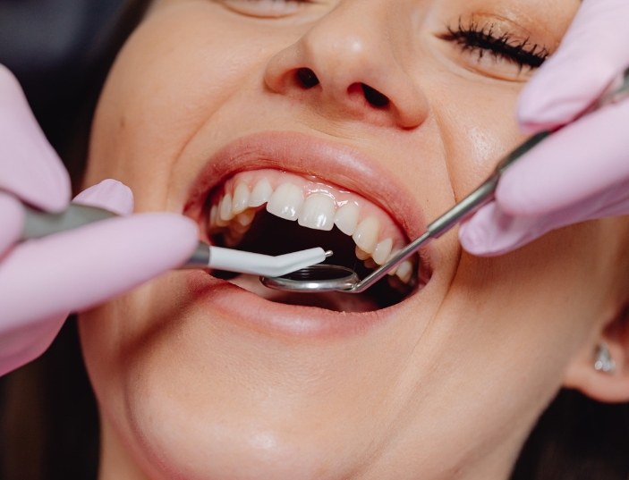 a dentist treating a girl in League City