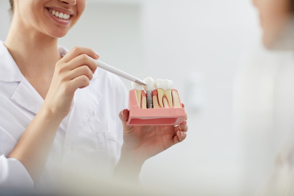 Dental Implants in Webster